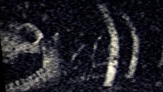 Inside the Backrooms é semelhante a Inside the Backrooms